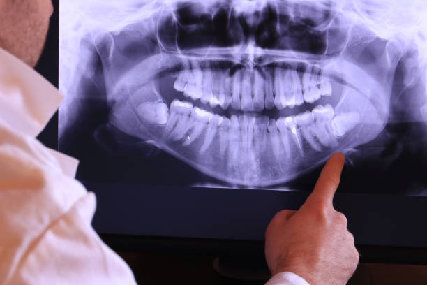 Best Emergency Dental Extractions in White Oak, PA