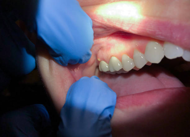 Best Broken or Cracked Tooth Emergency Dentist in White Oak, PA